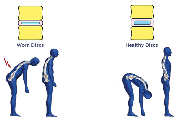 Posture and alignment